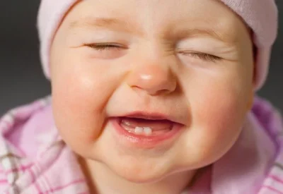 Trẻ bị tiêu chảy khi mọc răng 5+ Thông tin hữu ích mà mẹ cần biết