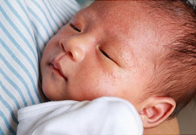 2+ Cách nhận biết trẻ sơ sinh dị ứng sữa mẹ
