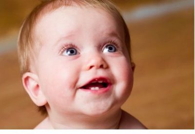 Trẻ chậm mọc răng – 3+ Điều bố mẹ cần lưu ý