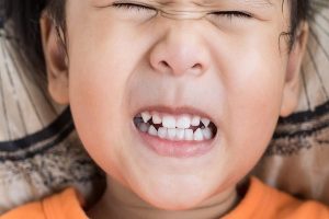 Read more about the article Mách mẹ 5+ bí quyết giúp trẻ giảm nghiến răng khi ngủ