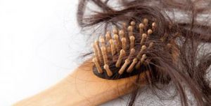 Rụng tóc và những nguyên nhân rụng tóc do dinh dưỡng