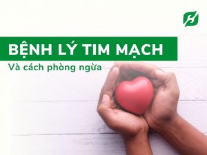 Read more about the article BỆNH LÝ TIM MẠCH VÀ 3+ CÁCH PHÒNG NGỪA