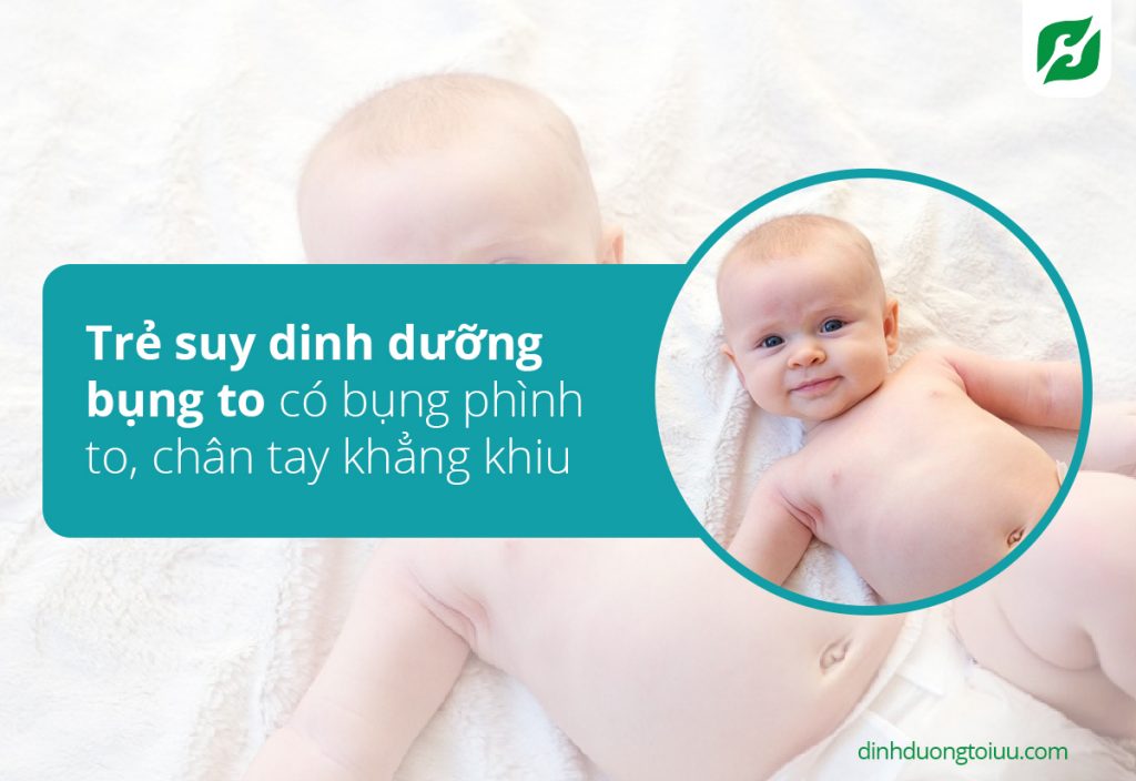 tre-suy-dinh-duong-bung-to-9