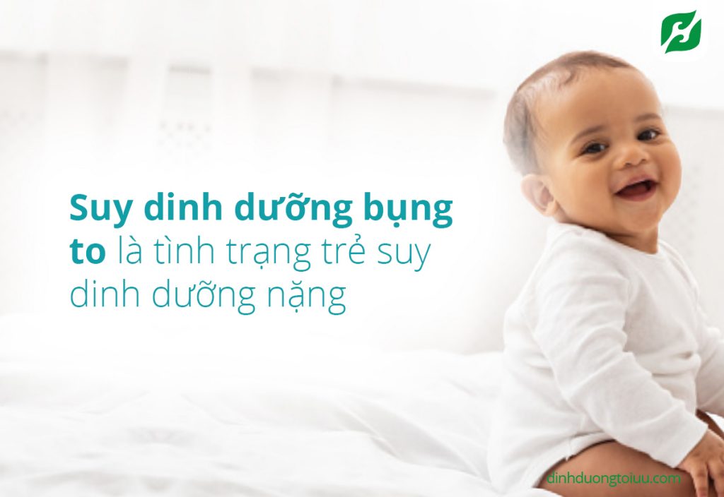 tre-suy-dinh-duong-bung-to-5