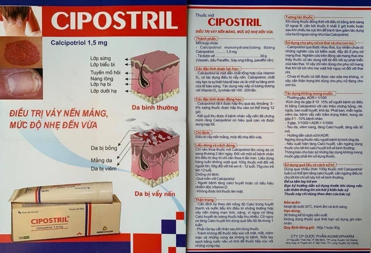 Thuốc điều trị vảy nến Cipostril 30g