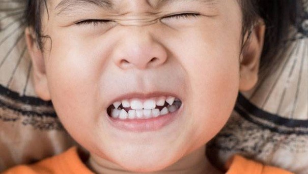 Trẻ Ngủ Bị Nghiến Răng