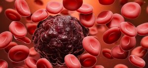 Read more about the article Giải đáp: Ung thư máu có chữa được không?