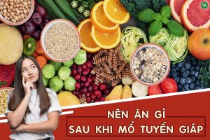Read more about the article Bệnh nhân sau mổ u tuyến giáp nên ăn gì, uống gì?