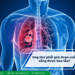 Ung thư phổi giai đoạn cuối sống được bao lâu?