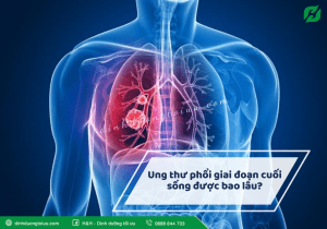 Read more about the article Ung thư phổi giai đoạn cuối sống được bao lâu?