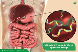 Vi khuẩn HP trong dạ dày có nguy hiểm không? Khuẩn HP trong dạ dày là gì?