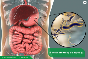 Vi khuẩn HP trong dạ dày có nguy hiểm không?