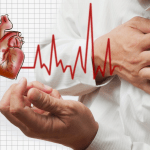 Rối loạn nhịp tim là gì? Các rối loạn nhịp tim thường gặp