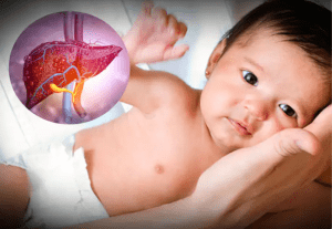 Dấu hiệu bệnh gan ở trẻ em