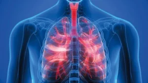 Read more about the article Tiểu đường biến chứng qua phổi có nguy hiểm không?