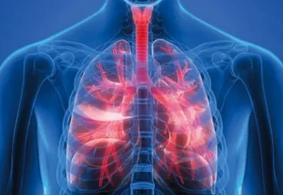Tiểu đường biến chứng qua phổi có nguy hiểm không?